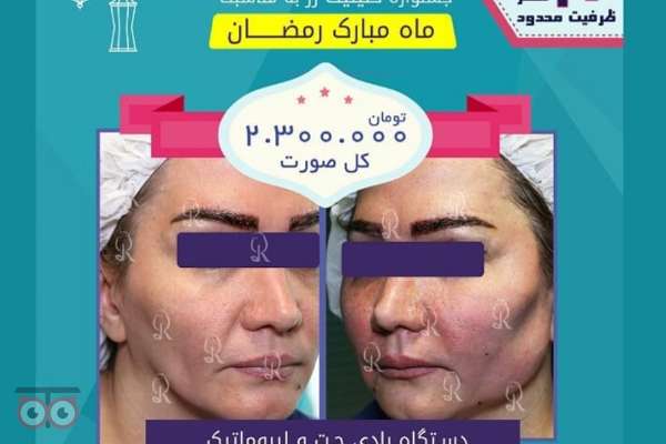 تخفیفات ویژه به مناسبت ماه مبارک رمضان تخفیفات ویژه به مناسبت ماه مبارک رمضان