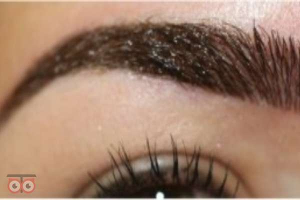 تخفیف ویژه کاشت ابرو