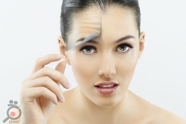 تخفیف ویژه بوتاکس تخفیف ویژه بوتاکس