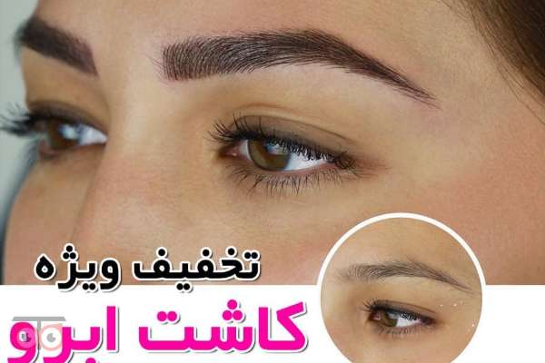 تخفیف ویژه کلینیک تندیس آریایی