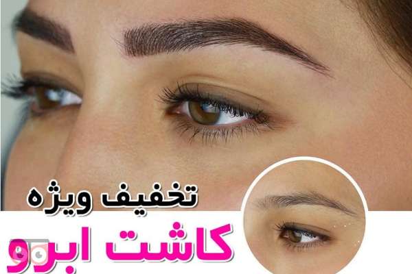 تخفیف ویژه کاشت ابرو به مناسبت عید قربان