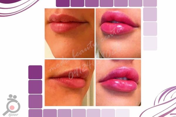 تخفیف ویژه عید تا عید