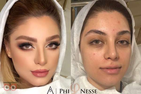 بازدید عروس همراه با آفر ویژه قرارداد