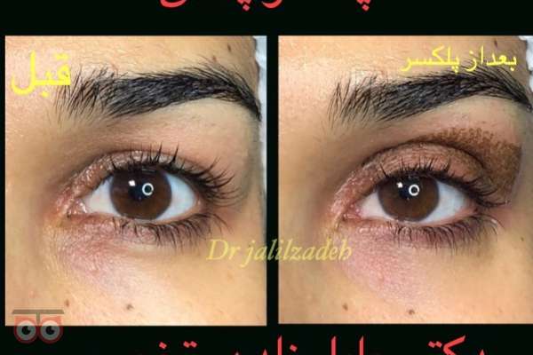 تخفیف ویژه خدمات زیبایی