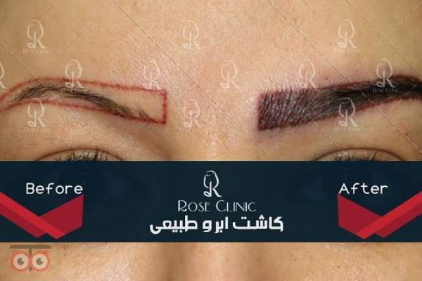 تمدید جشنواره کاشت تمدید جشنواره کاشت