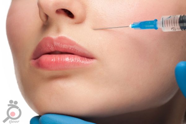 تخفیف ویژه تزریق ژل