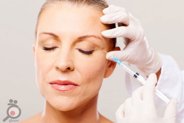 تخفیف ویژه تزریق فیلر تخفیف ویژه تزریق فیلر