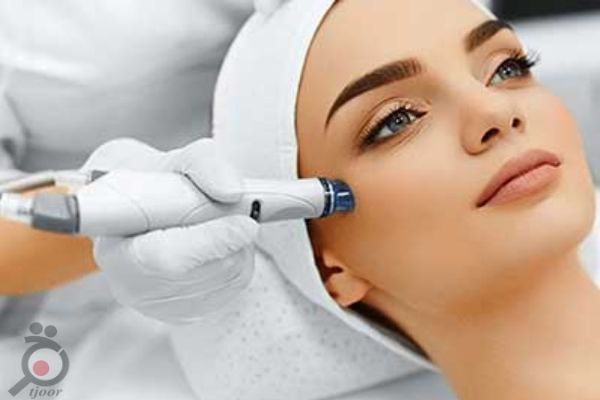 تخفیف ویژه میکرودرم ابریژن تخفیف ویژه میکرودرم ابریژن