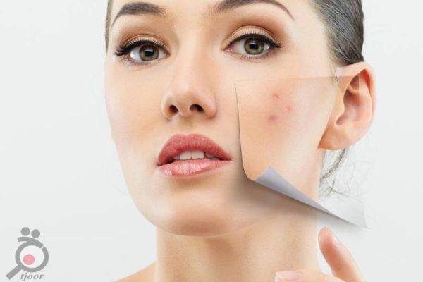 ورکشاپ تخصصی مراقبت از پوست