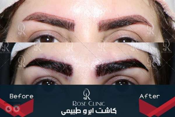 جشنواره کلینیک رز جشنواره کلینیک رز