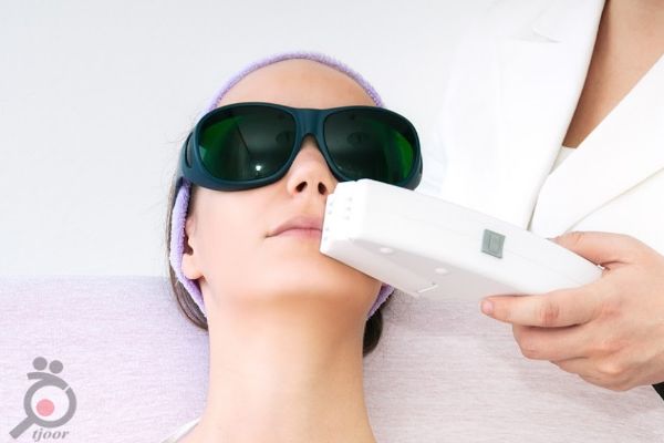 تخفیف ویژه لیزر موهای زائد