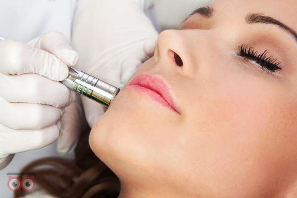 تخفیف ویژه آر اف و میکرودرم