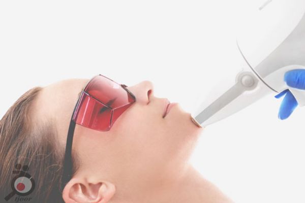 تخفیف ویژه لیزر تخفیف ویژه لیزر