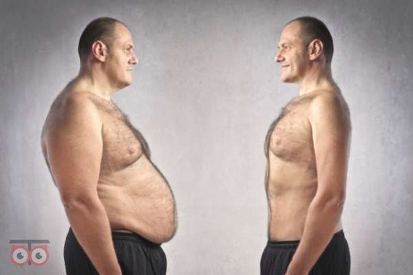 تخفیف ویژه ابدومینوپلاستی در شیراز