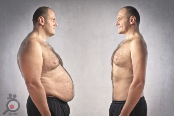 تخفیف ویژه فریز چربی تخفیف ویژه فریز چربی