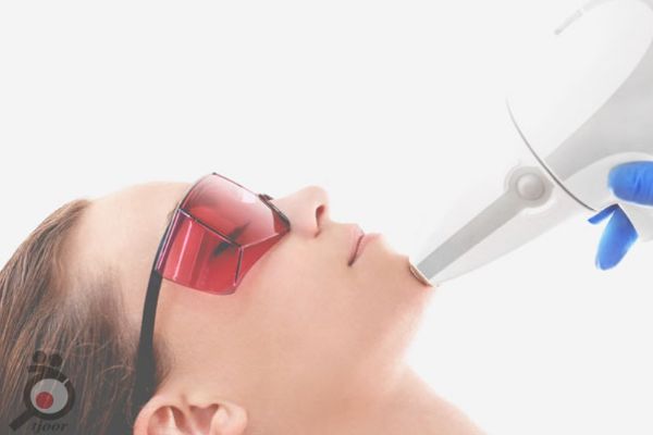 تخفیف تابستانی لیزر تخفیف تابستانی لیزر