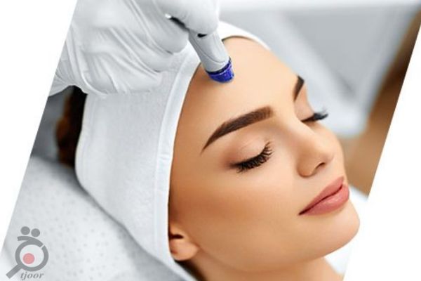 تخفیف ویژه میکرودرم ابریژن