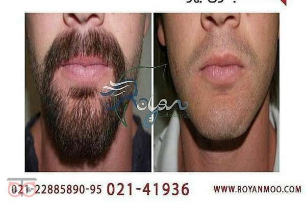 جشنواره تابستان کلینیک رویان جشنواره تابستان کلینیک رویان