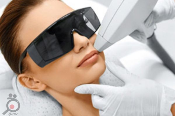 تخفیف ویژه تخفیف ویژه