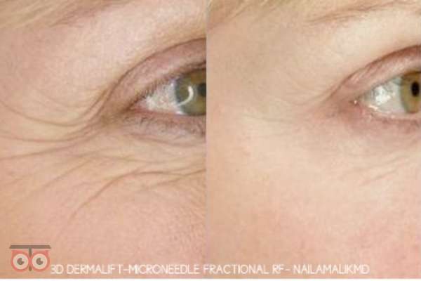 تخفیف ویژه آراکس