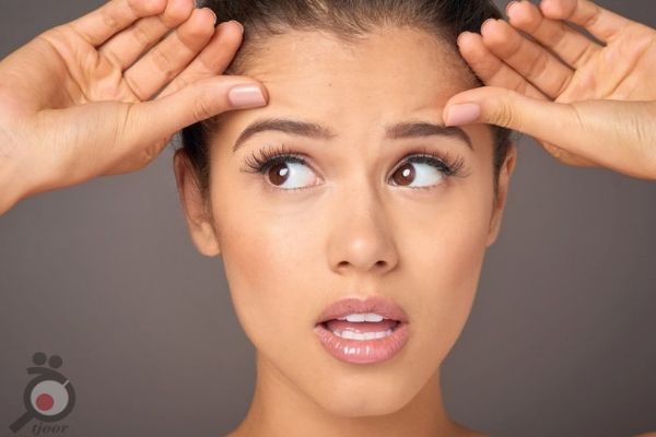 تخفیف ویژه بوتاکس