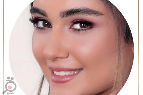 بازدید عروس همراه با تخفیف قرارداد