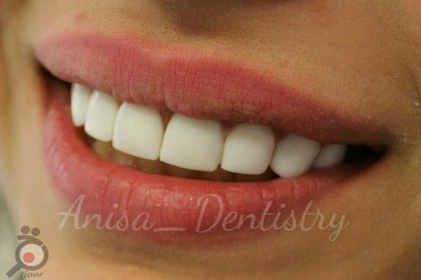 جشنواره تخفیفات کلینیک آنی سا