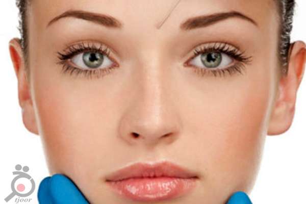 تخفیف لیزر موهای زائد