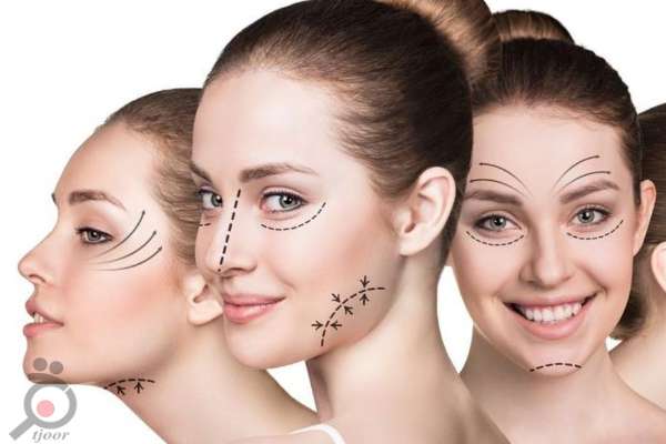 تخفیف ویژه خدمات زیبایی و بهداشتی کلینیک ایرانیان