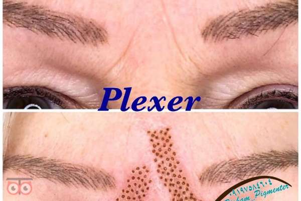 کارگاه آموزش میکرونیدلینگ کارگاه آموزش میکرونیدلینگ