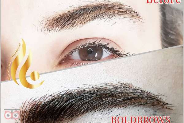 تخفیف ویژه خدمات میکروپیگمنتیشن