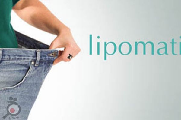 تخفیف لیپوماست شکم و پهلو
