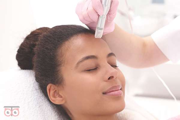 تخفیف خدمات میکرونیدلینگ