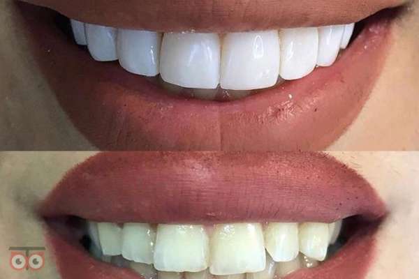 جشنواره تخفیفات خدمات دهان و دندان