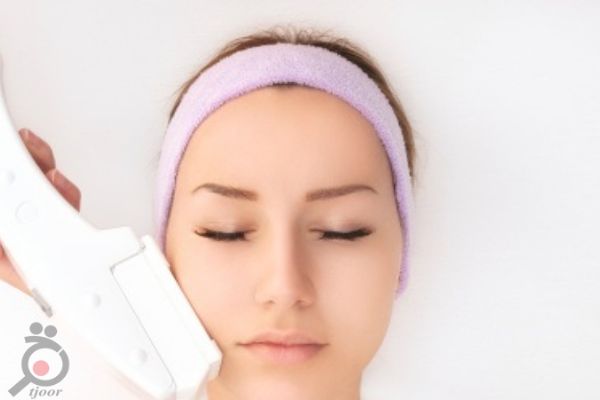 تخفیف ویژه لیزر موهای زائد