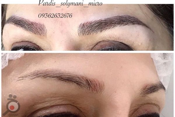 تخفیف ویژه خدمات میکروپیگمنتیشن