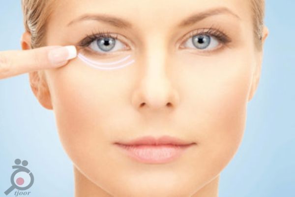 تخفیف تزریق ژل آلمانی