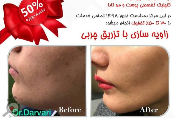 تخفیف نوروزی کلینیک تابا