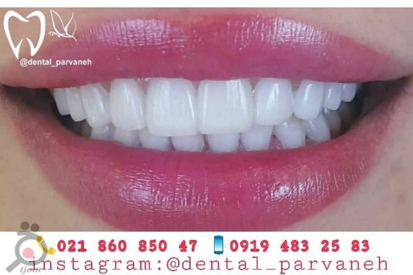 تخفیف خدمات دندانپزشکی