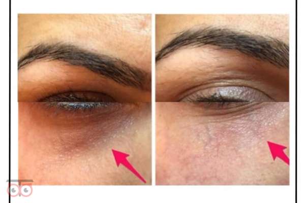 تخفیف ویژه خدمات زیبایی کلینیک دریتا