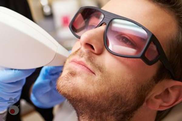 تخفیف ویژه شعبان لیزر موهای زائد