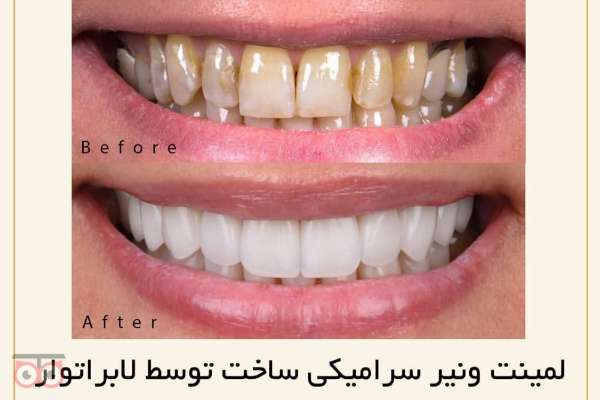 تخفیف ویژه خدمات دندانپزشکی