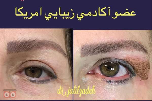 تخفیف ویژه خدمات جوانسازی و رفع چین و چروک