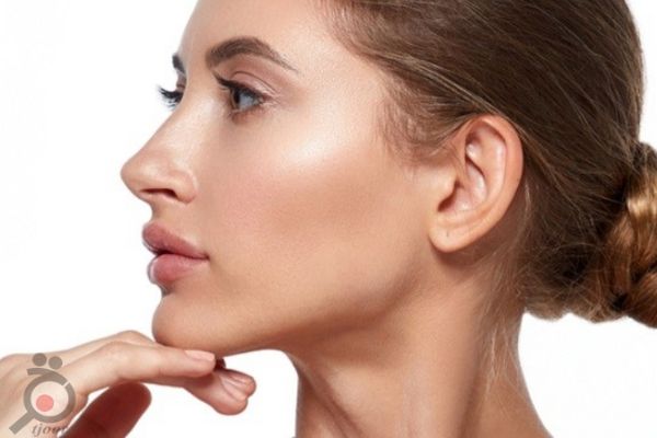 تخفیف لیفت با پلاتینیوم 2019