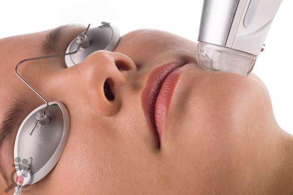 تخفیف میکرونیدلینگ تخفیف میکرونیدلینگ