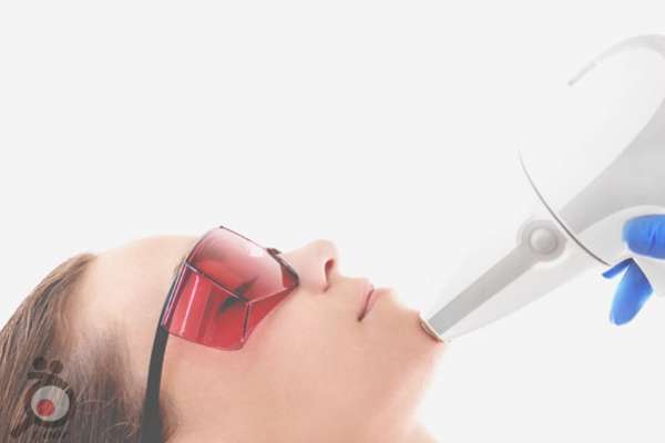 تخفیف ویژه لیزر موهای زائد تخفیف ویژه لیزر موهای زائد