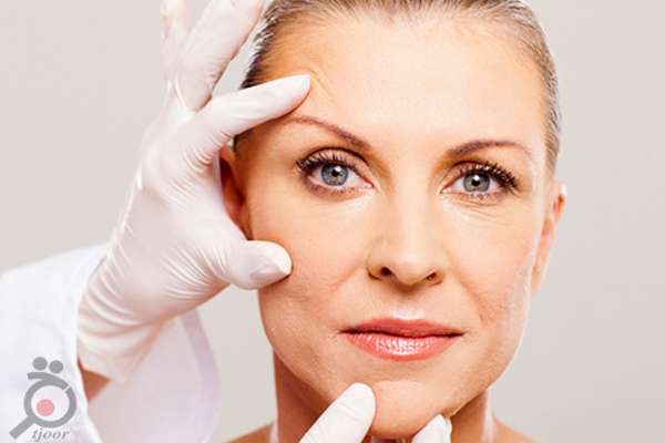 تخفیف ویژه خدمات لیفت و بلفاروپلاستی