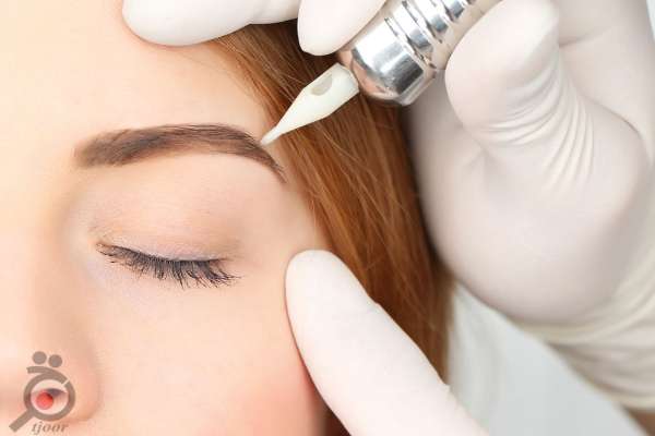 تخفیف تابستانی میکروپیگمنتیشن