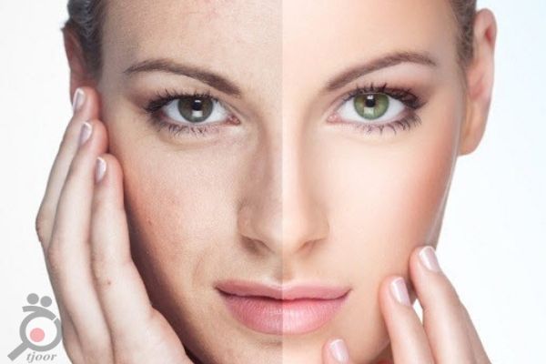 تخفیف تابستانی انواع خدمات زیبایی