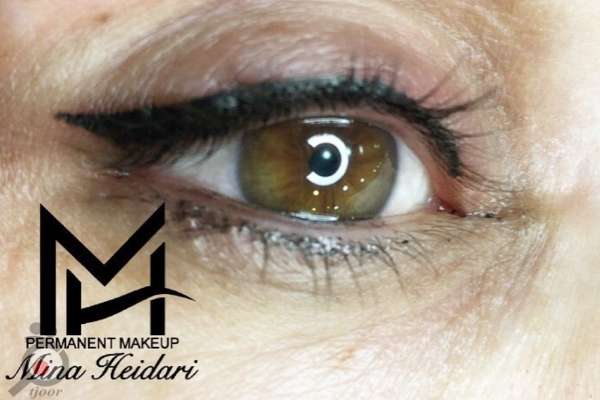 تخفیف خدمات میکروبلیدینگ